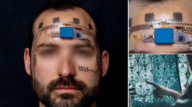 Electronic tattoo against stressful work: It gives an alarm when you work too much