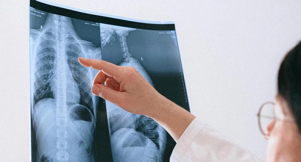Die onkologische Diagnostik hinkt noch hinterher. Experten warnen: Patienten warten zu lange