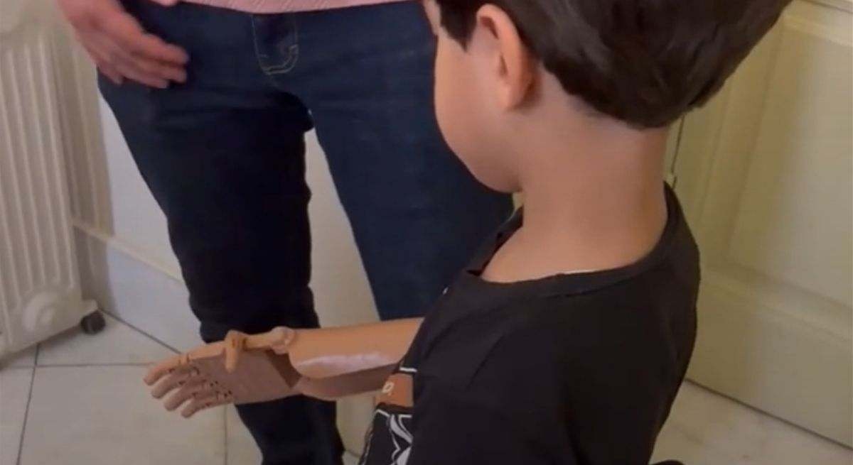 Ayúdame3D: the Spanish NGO that designs and delivers 3D-printed prostheses for children with amputations in Gaza.
