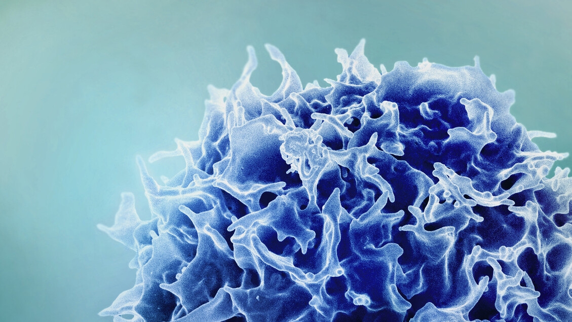 Désarmer les cellules immunitaires rebelles responsables de nombreuses maladies