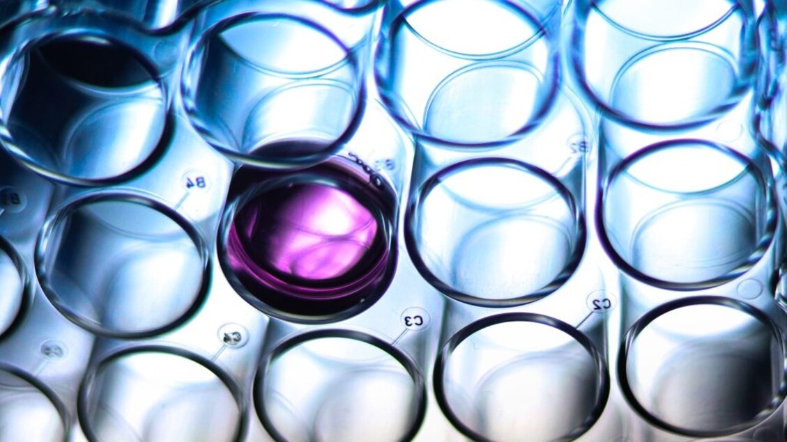 Novas moléculas anticancerígenas matam células doentes com mais força