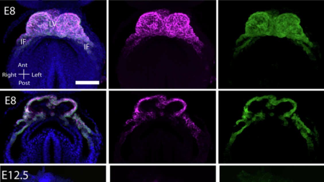 Heart Birth Filmed in 3D in a Mouse Embryo