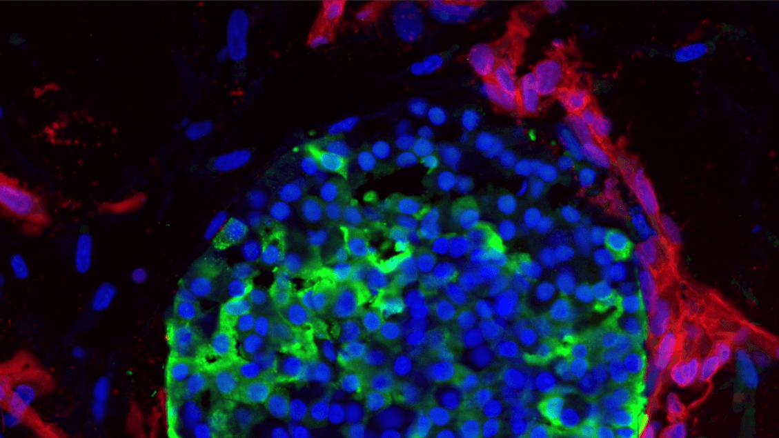 I primi organoidi con un sistema di vasi sanguigni