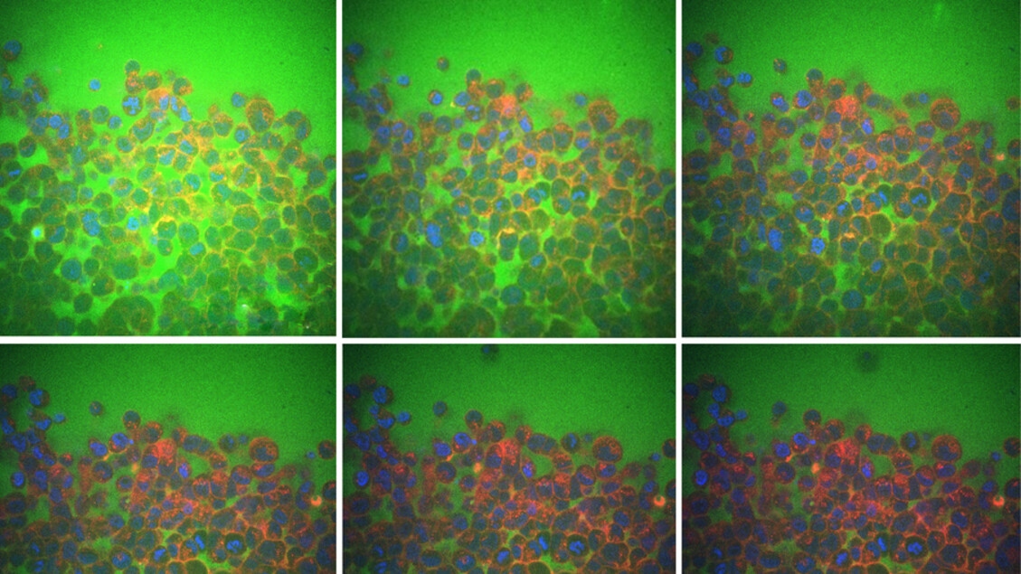 L'elasticità dei tessuti dipende dall'acqua fra le cellule