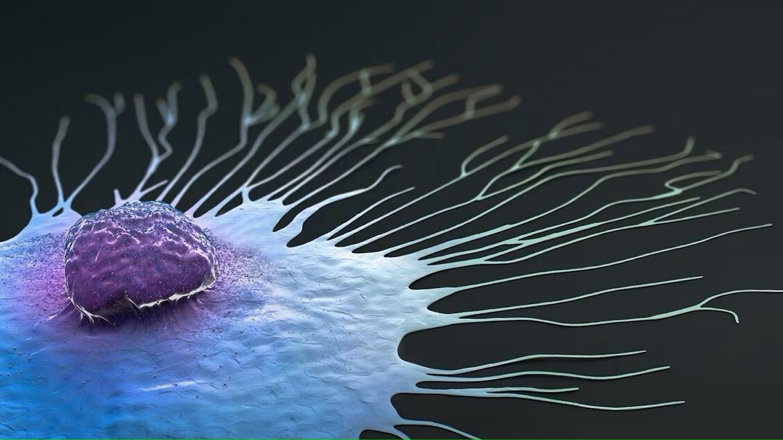 Car-T Therapy, First Positive Results Against the Most Difficult Tumors