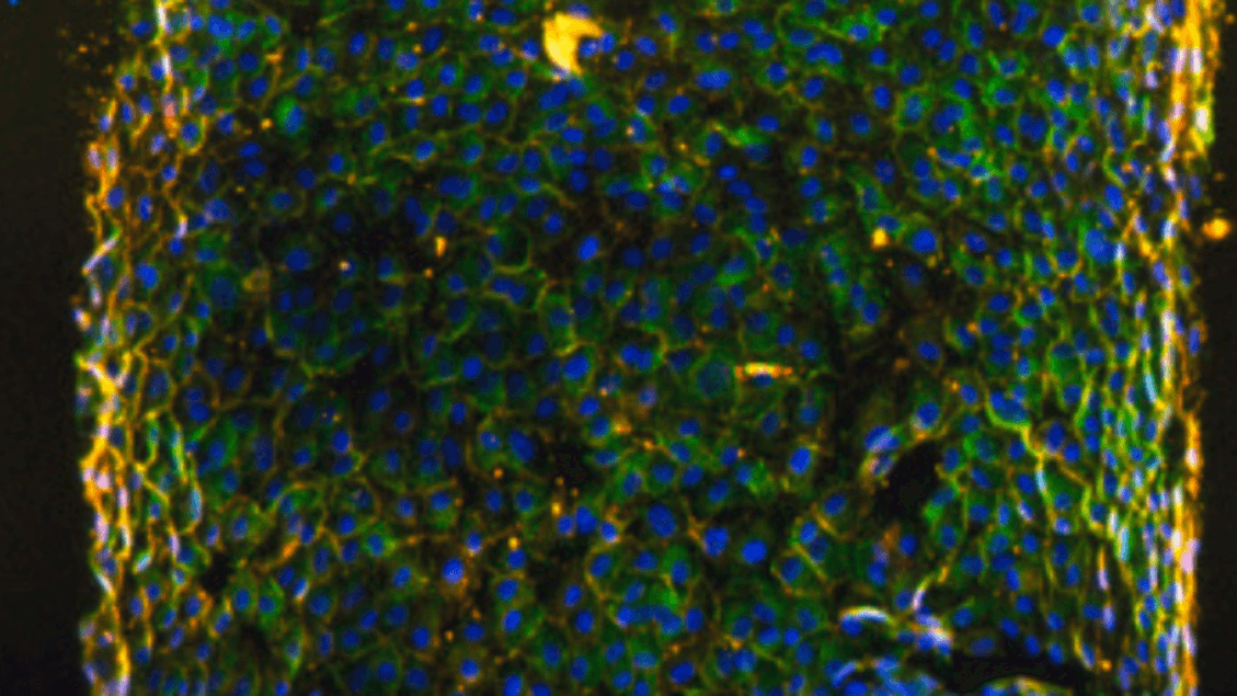 Le bioréacteur qui reproduit les tumeurs en laboratoire est prêt