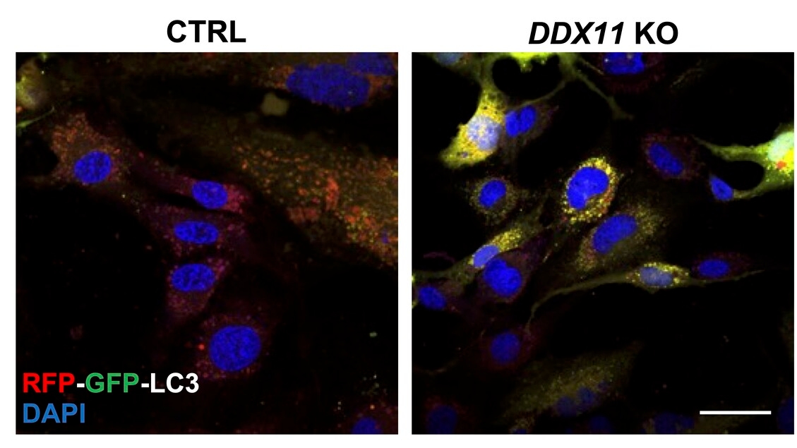 Une protéine à double fonction contre la neurodégénérescence