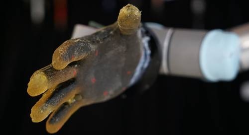 Robotic skin developed that can detect pressure, temperature and pain