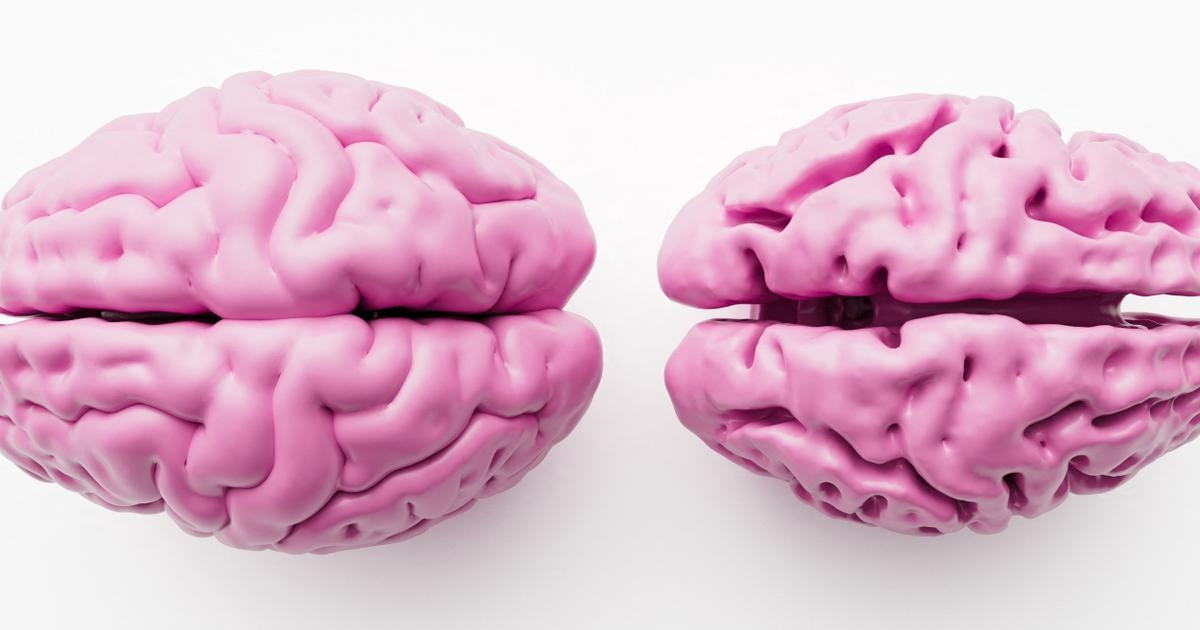 Mózg kobiet kurczy się wolniej, ale nie jest on chroniony przed chorobą Alzheimera.